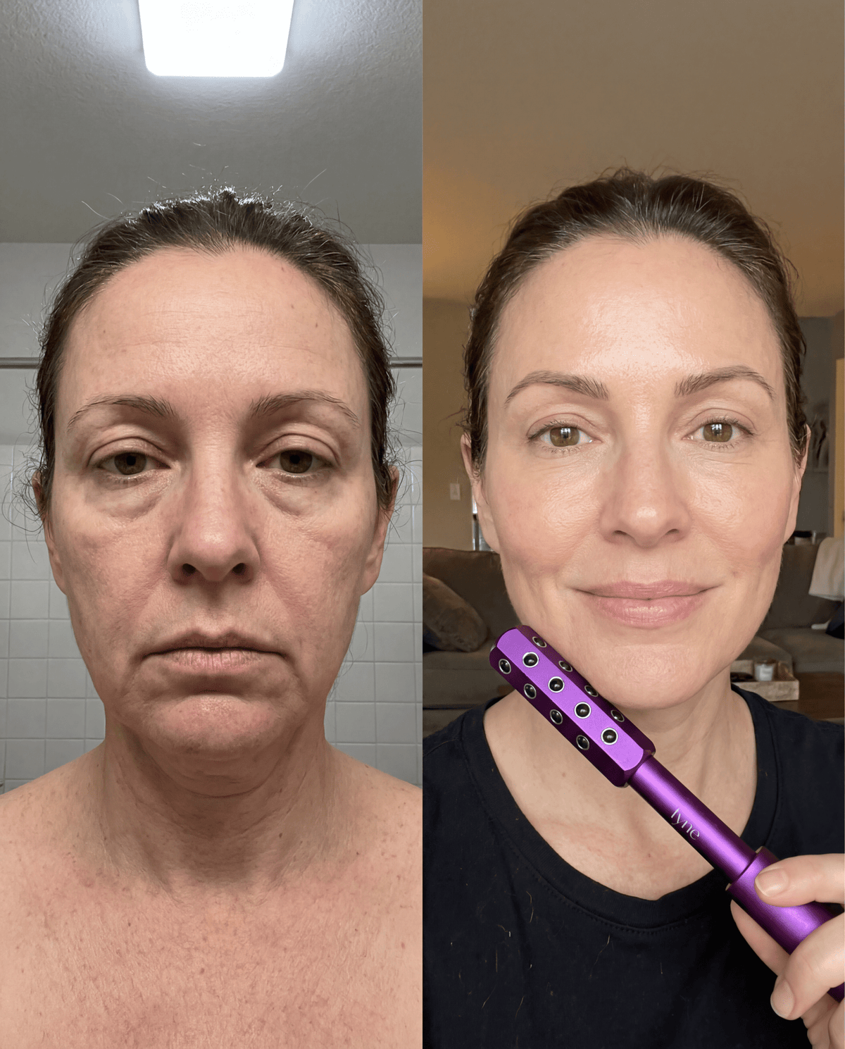 Beauty Sculptor Roller for Face, Uplifting Facial Massager for Skin Firming and Glow – | Fyne Skincare